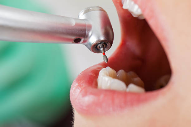 Best Emergency Denture Repair in Paloma Creek South, TX